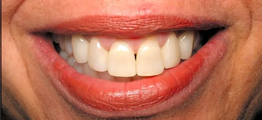 A completed case at the Kurpis Center.