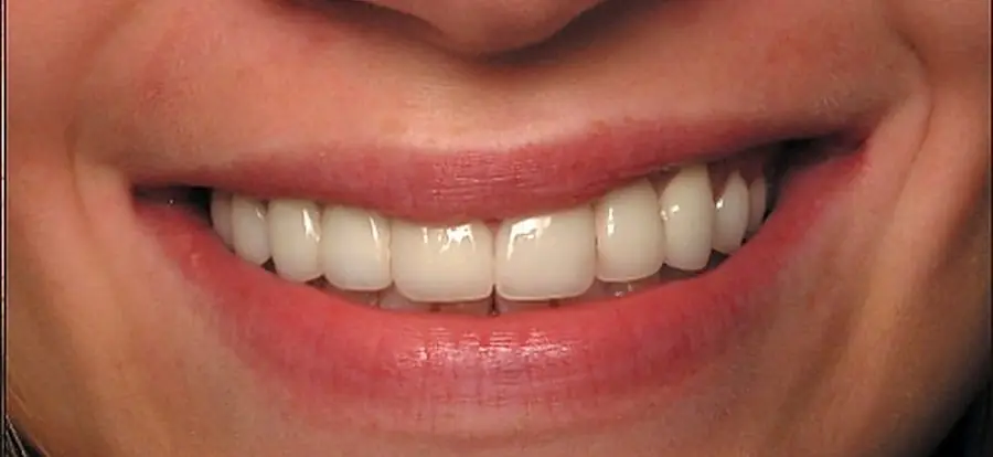 A restored smile.