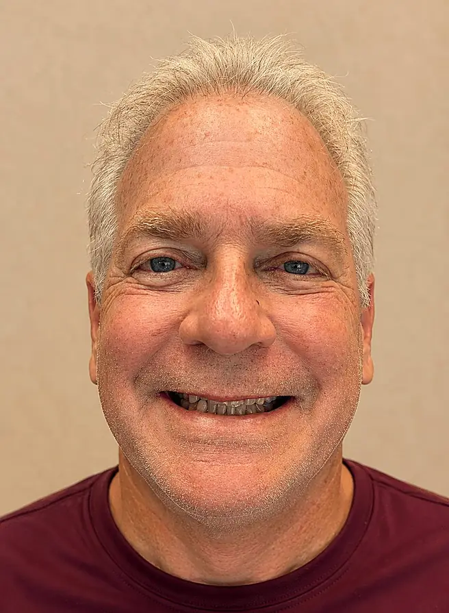 A patient after restorative treatment.